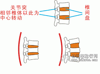 腰椎姿态和椎间盘压力的关系